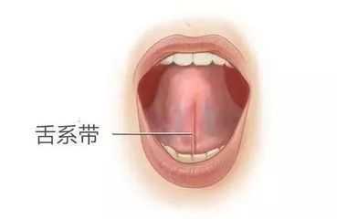 熟悉又陌生的大舌头到底是啥东西？它只是因为